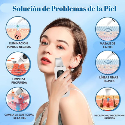 Paleta Ultrasónica Facial — Limpieza Profunda y Piel Radiante